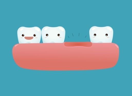Dentures