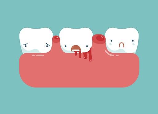 what is gum disease?