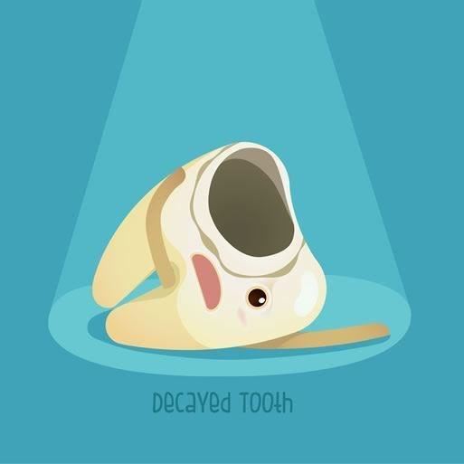 Decayed Tooth Dental Filling